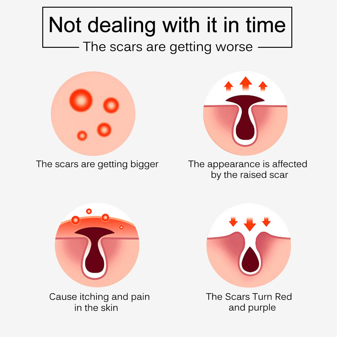 Skin Rebound Scarless Cream Scar Removal Cream Face Cream For Face Acne Scar Stretch Marks Skin Repair Face Cream Skin Rebound Scarless Cream Scar Removal Cream Face Cream For Face Acne Scar Stretch Marks Skin Repair Face Cream